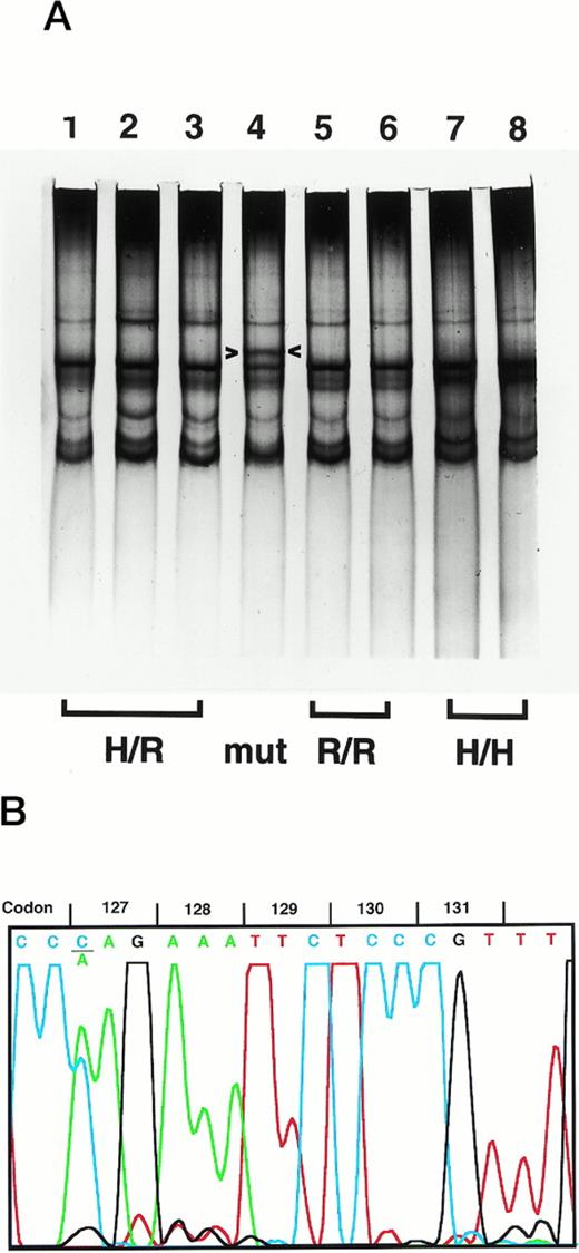 Fig. 1. Detection of the FcγRIIA K 127 mutation. (A) SSCP analysis of the FcγRIIA PCR product from genomic DNA is shown. In lane 4, a unique SSCP pattern (arrowheads, top band) is seen in comparison with H/R131 (lanes 1 through 3), R/R131 (lanes 5 and 6), and H/H131 (lanes 7 and 8) samples. (B) DNA sequence analysis of the PCR product with the unique SSCP pattern shows heterozygosity for C (blue) and A (green) at the first nucleotide of codon 127. The sequence also indicates R/R131 homozygosity (G, black, at the second nucleotide of codon 131).