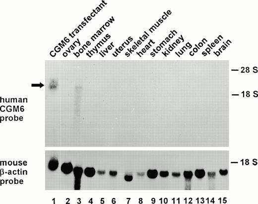 Fig. 4. Northern blot analysis of human CGM6 mRNA in various organs from a CGM6-transgenic mouse. Total RNA from various organs of a CGM6-transgenic mouse and as a positive control RNA from a CGM6-HeLa transfectant10 were size-separated on a denaturing agarose gel. After transfer to a nylon membrane, they were hybridized with a CGM6 cDNA probe. The positions of the 28S and 18S rRNAs are indicated. In the lower part of the figure, the same blot was hybridized with a mouse β-actin cDNA probe.