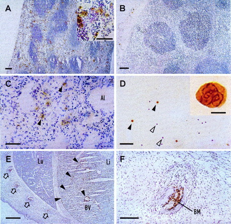 Fig. 5. Immunohistochemical detection of human CD66b expression in CGM6-transgenic mice. Cryosections from various organs were incubated with a polyclonal rabbit anti-NCA antiserum followed by a peroxidase-coupled, antirabbit IgG and stained for peroxidase activity (brown). Counterstaining of nuclei was with hematoxylin (blue). (A) The spleen from a CGM6-transgenic mouse shows staining of granulocytes (see inset) mainly in the red pulp areas. (B) The spleen from a nontransgenic sibling mouse is negative. The lung (C) and a blood smear (D) of a CGM6-transgenic mouse also show granulocyte staining (Al = alveolus). Black arrowheads indicate stained granulocytes (see inset in D) and white arrowheads are nonstaining lymphocytes. (E) Section through the lung (Lu) and liver (Li) of a day 17.5 CGM6-transgenic mouse fetus. Black arrowheads show granulocyte staining concentrated along the edge of a liver lobe and lining a blood vessel (BV). Open arrows show ribs containing stained granulocytes in the bone marrow. (F) Higher magnification showing stained granulocytes in the rib bone marrow (BM). Bars = 5 μm (D: inset), 50 μm (A: inset, C and D), 100 μm (A, B, and F), and 500 μm (E).