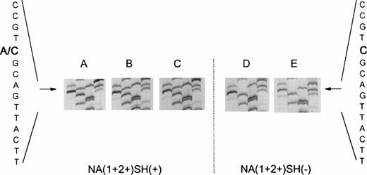 Fig. 2. Nucleotide sequence (GATC) ofFcγRIIIB-NA2–specific genomic DNA fragments. (A to C) Fragments from three NA(1+2+)SH(+) individuals. Two bands (A and C) are visible at nucleotide position 266, indicating the presence of a normal (266C) as well as of a mutated (266A) FcγRIIIB-NA2 gene. (D and E) Sequences of NA(1+2+)SH(−) controls.