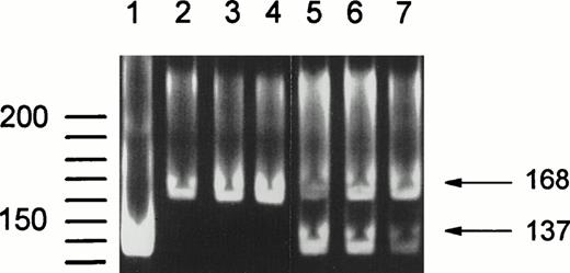 Fig. 3. SfaNI digestion of the 168-bpFcγRIIIB-NA2–specific gDNA fragment containing the SH mutation at nucleotide position 266. SfaNI recognizes a 5′-GATGC-3′ sequence, which is only present in theFcγRIIIB-SH gene. Lane 1 shows digestion of a fragment amplified from a plasmid containing SH-FcγRIIIb–encoding cDNA, confirming that complete digestion is obtained by Sfa NI treatment. DNA fragments from NA(1+,2+)SH(−) individuals were not digested (lanes 2 through 4), whereas an additional band of 137 bp is visible after digestion of fragments from SH(+) individuals (lanes 5 through 7).