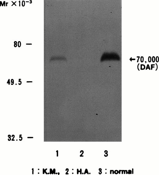 Fig. 1. Immunoblotting of erythrocyte membranes with anti-DAF antibody CBC98. The DAF band at 70 kD is present in normal controls and in Dr(a−) (weaker than normal) but not in H.A. Lane 1, Dr(a−); lane 2, H.A.; lane 3, normal control.