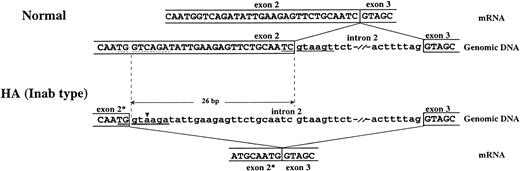 Fig. 5. Schematic representation of alternative splicing of the DAF gene in H.A. An alternatively spliced mRNA results from the activation of a cryptic splice site due to a C→A mutation upstream from the normal splice site. This abnormal mRNA lacks the last 26 bp of exon 2, which causes a reading frame shift and creates a stop codon next to the end of the deletion. (▾) base substitution, (—) normal 5′-splice site, (dashed line) cryptic 5′-splice site, (=) mutated 5′-splice site, (*) the truncated exon.