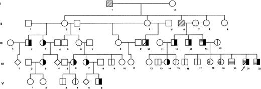 Fig. 1. Pedigree of Portuguese family shows segregation of dominantly transmitted β-thalassemia determinant. Propositus is marked by arrow. (╞) βAβthal; (⊟) αααanti3.7/αα; (│) normal tested; (▨) dead; (◊) sex unknown, individual not studied. All remaining individuals were not studied.