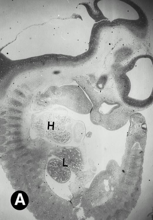 Fig. 3. P4.2 gene expression in E10.5 embryos. Bright-field and dark-field views are displayed of hybridization of sagittal sections of embryos at E10.5 days with the P4.2 antisense riboprobe (A and B). Higher-power views of the heart (C and D) or liver (E and F) region are also shown. P4.2 hybridization signal was observed in the erythroid cells in the sinusoids and vessels of the liver (representatives are marked with arrowheads). (A, C, and E) Bright-field illumination; (B, D, and F) dark-field illumination. H, heart; L, liver. Micrographs were taken with a 10× (A and B) or 20× (C, D, E, and F) objective.