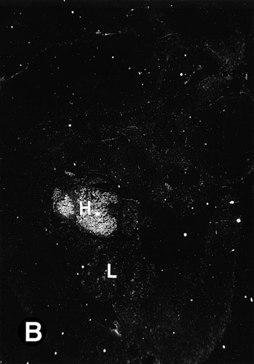 Fig. 3. P4.2 gene expression in E10.5 embryos. Bright-field and dark-field views are displayed of hybridization of sagittal sections of embryos at E10.5 days with the P4.2 antisense riboprobe (A and B). Higher-power views of the heart (C and D) or liver (E and F) region are also shown. P4.2 hybridization signal was observed in the erythroid cells in the sinusoids and vessels of the liver (representatives are marked with arrowheads). (A, C, and E) Bright-field illumination; (B, D, and F) dark-field illumination. H, heart; L, liver. Micrographs were taken with a 10× (A and B) or 20× (C, D, E, and F) objective.