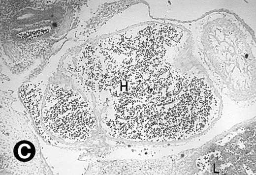 Fig. 3. P4.2 gene expression in E10.5 embryos. Bright-field and dark-field views are displayed of hybridization of sagittal sections of embryos at E10.5 days with the P4.2 antisense riboprobe (A and B). Higher-power views of the heart (C and D) or liver (E and F) region are also shown. P4.2 hybridization signal was observed in the erythroid cells in the sinusoids and vessels of the liver (representatives are marked with arrowheads). (A, C, and E) Bright-field illumination; (B, D, and F) dark-field illumination. H, heart; L, liver. Micrographs were taken with a 10× (A and B) or 20× (C, D, E, and F) objective.