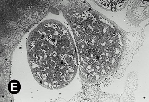 Fig. 3. P4.2 gene expression in E10.5 embryos. Bright-field and dark-field views are displayed of hybridization of sagittal sections of embryos at E10.5 days with the P4.2 antisense riboprobe (A and B). Higher-power views of the heart (C and D) or liver (E and F) region are also shown. P4.2 hybridization signal was observed in the erythroid cells in the sinusoids and vessels of the liver (representatives are marked with arrowheads). (A, C, and E) Bright-field illumination; (B, D, and F) dark-field illumination. H, heart; L, liver. Micrographs were taken with a 10× (A and B) or 20× (C, D, E, and F) objective.