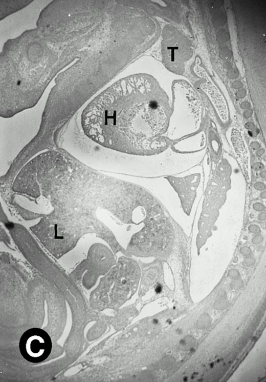 Fig. 5. Expression of the P4.2 transcript during liver development. Shown are bright-field (A, C, E, and G) and dark-field (B, D, F, and H) views of hybridization to the P4.2 antisense riboprobe. (A and B) The liver from an E12.5 (A and B) embryo section; (C and D) the abdominal region containing the liver from an E14.5 (C and D) or E16.5 (E and F) embryo; (G and H) a section of liver from the mouse at 4 weeks after birth. T, thymus; H, heart; L, liver; M, metanephros. Micrographs were taken with a 20× (A, B, G, and H) or 2.5× (C, D, E, and F) objective.