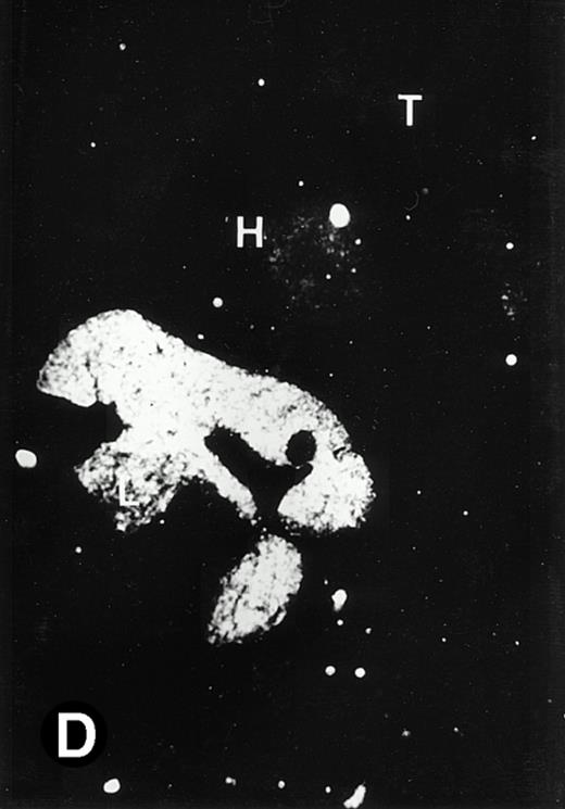 Fig. 5. Expression of the P4.2 transcript during liver development. Shown are bright-field (A, C, E, and G) and dark-field (B, D, F, and H) views of hybridization to the P4.2 antisense riboprobe. (A and B) The liver from an E12.5 (A and B) embryo section; (C and D) the abdominal region containing the liver from an E14.5 (C and D) or E16.5 (E and F) embryo; (G and H) a section of liver from the mouse at 4 weeks after birth. T, thymus; H, heart; L, liver; M, metanephros. Micrographs were taken with a 20× (A, B, G, and H) or 2.5× (C, D, E, and F) objective.