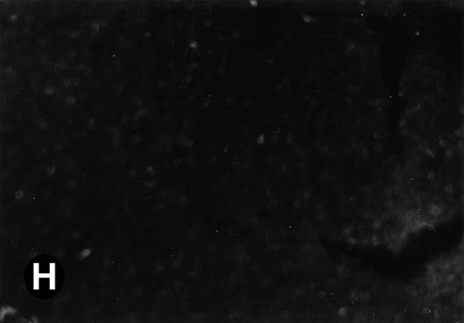 Fig. 5. Expression of the P4.2 transcript during liver development. Shown are bright-field (A, C, E, and G) and dark-field (B, D, F, and H) views of hybridization to the P4.2 antisense riboprobe. (A and B) The liver from an E12.5 (A and B) embryo section; (C and D) the abdominal region containing the liver from an E14.5 (C and D) or E16.5 (E and F) embryo; (G and H) a section of liver from the mouse at 4 weeks after birth. T, thymus; H, heart; L, liver; M, metanephros. Micrographs were taken with a 20× (A, B, G, and H) or 2.5× (C, D, E, and F) objective.