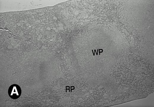 Fig. 6. P4.2 gene expression in the mouse spleen and bone marrow. Shown are in situ hybridization analysis of serial spleen sections from a 15-day-old mouse (A through D) using the P4.2 antisense riboprobe. A representative region of red pulp (RP) or white pulp (WP) in the spleen is indicated in (A) and (B). Higher-power views of a red pulp region are shown in (C) and (D). The lightly stained areas (labeled with “E”) enrich more mature erythroid cells and show substantial P4.2 hybridization. Arrowheads indicate isolated megakaryocytes. Sections containing bone marrows from a 7-day-old mouse (E and F) were also hybridized with the P4.2 antisense riboprobe. A representative erythroid colony in the bone marrow is labeled with “E.” Micrographs were taken with a 20× (A and B) or 40× (C through F) objective. (A, C, and E) Bright-field illumination; (B, D, and F) dark-field illumination.