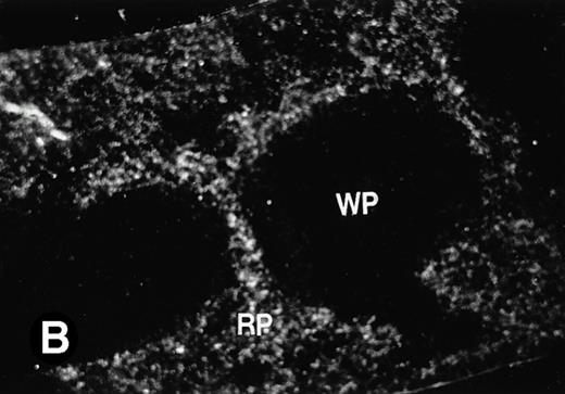 Fig. 6. P4.2 gene expression in the mouse spleen and bone marrow. Shown are in situ hybridization analysis of serial spleen sections from a 15-day-old mouse (A through D) using the P4.2 antisense riboprobe. A representative region of red pulp (RP) or white pulp (WP) in the spleen is indicated in (A) and (B). Higher-power views of a red pulp region are shown in (C) and (D). The lightly stained areas (labeled with “E”) enrich more mature erythroid cells and show substantial P4.2 hybridization. Arrowheads indicate isolated megakaryocytes. Sections containing bone marrows from a 7-day-old mouse (E and F) were also hybridized with the P4.2 antisense riboprobe. A representative erythroid colony in the bone marrow is labeled with “E.” Micrographs were taken with a 20× (A and B) or 40× (C through F) objective. (A, C, and E) Bright-field illumination; (B, D, and F) dark-field illumination.