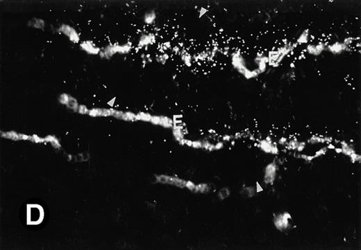 Fig. 6. P4.2 gene expression in the mouse spleen and bone marrow. Shown are in situ hybridization analysis of serial spleen sections from a 15-day-old mouse (A through D) using the P4.2 antisense riboprobe. A representative region of red pulp (RP) or white pulp (WP) in the spleen is indicated in (A) and (B). Higher-power views of a red pulp region are shown in (C) and (D). The lightly stained areas (labeled with “E”) enrich more mature erythroid cells and show substantial P4.2 hybridization. Arrowheads indicate isolated megakaryocytes. Sections containing bone marrows from a 7-day-old mouse (E and F) were also hybridized with the P4.2 antisense riboprobe. A representative erythroid colony in the bone marrow is labeled with “E.” Micrographs were taken with a 20× (A and B) or 40× (C through F) objective. (A, C, and E) Bright-field illumination; (B, D, and F) dark-field illumination.