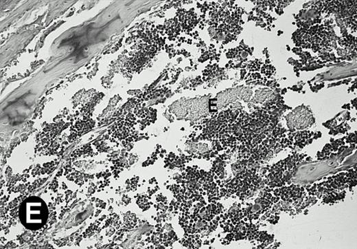 Fig. 6. P4.2 gene expression in the mouse spleen and bone marrow. Shown are in situ hybridization analysis of serial spleen sections from a 15-day-old mouse (A through D) using the P4.2 antisense riboprobe. A representative region of red pulp (RP) or white pulp (WP) in the spleen is indicated in (A) and (B). Higher-power views of a red pulp region are shown in (C) and (D). The lightly stained areas (labeled with “E”) enrich more mature erythroid cells and show substantial P4.2 hybridization. Arrowheads indicate isolated megakaryocytes. Sections containing bone marrows from a 7-day-old mouse (E and F) were also hybridized with the P4.2 antisense riboprobe. A representative erythroid colony in the bone marrow is labeled with “E.” Micrographs were taken with a 20× (A and B) or 40× (C through F) objective. (A, C, and E) Bright-field illumination; (B, D, and F) dark-field illumination.