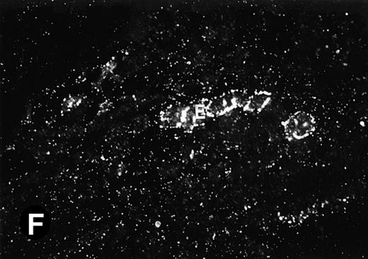 Fig. 6. P4.2 gene expression in the mouse spleen and bone marrow. Shown are in situ hybridization analysis of serial spleen sections from a 15-day-old mouse (A through D) using the P4.2 antisense riboprobe. A representative region of red pulp (RP) or white pulp (WP) in the spleen is indicated in (A) and (B). Higher-power views of a red pulp region are shown in (C) and (D). The lightly stained areas (labeled with “E”) enrich more mature erythroid cells and show substantial P4.2 hybridization. Arrowheads indicate isolated megakaryocytes. Sections containing bone marrows from a 7-day-old mouse (E and F) were also hybridized with the P4.2 antisense riboprobe. A representative erythroid colony in the bone marrow is labeled with “E.” Micrographs were taken with a 20× (A and B) or 40× (C through F) objective. (A, C, and E) Bright-field illumination; (B, D, and F) dark-field illumination.