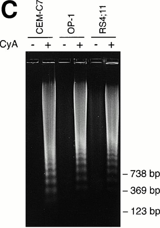 Fig. 2. CyA induces apoptosis in ALL cells. The T-lineage ALL cell line CEM-C7 and the B-lineage ALL cell lines OP-1 (carrying the Philadelphia chromosome) and RS4;11 (with MLL gene rearrangements) were incubated with CyA (10 μmol/L) or the vehicle (ethanol 0.1%) for 48 hours. (A) Flow-cytometric dot plots illustrate changes in cell light-scatter properties typical of apoptosis caused by exposure to CyA. These consisted of decreased cell size (forward scatter, FSC; x-axis) and increased cell granularity (side scatter, SSC; y-axis). (B) Isometric contour plots illustrate binding of Annexin-V to phosphatidyl serine residues on the cell membrane (a feature of apoptosis) and propidium iodide labeling due to cell membrane permeabilization caused by CyA. (C) In all 3 cell lines, CyA induced a DNA ladder of a multiple of 180 base pairs, characteristic of apoptosis. Molecular mass markers are indicated.