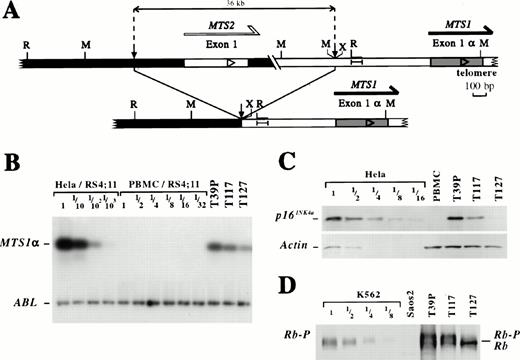 Fig. 1. Genomic configuration, MTS1 product expression and Rb phosphorylation in three cases with a short interstitial deletion. (A) Schematic representation of the 36-kb interstitial deletion occurring in the MTS locus in T39p, T117, and T127. Small vertical arrows indicate breakpoints. Large horizontal arrows indicate the transcriptional orientation. The DNA sequences involved in transcriptional activation of the promotor located 5′ to theMTS1 exon 1α in cells with physical or functional Rb inactivation24 are shown: I—-I. R: EcoRI; M:Mbo I, X: Xba I restriction sites. The Xba I site has been deleted by the V(D)J process in the T39p sample.7 (B) RT-PCR detection of ABL (30 PCR cycles) andMTS1α (26 PCR cycles) transcripts in T39p, T117, and T127 samples and in dilutions of Hela and PBMC RNAs into RS4;11 RNAs (results observed in this experiment for other T-ALL cases are shown in Fig 3A). PCR products were electrophoresed on agarose gels, transferred to filters and hybridized with specific radiolabeled oligoprobes. The Hela cell line expresses high level MTS1α; MTS1 is deleted on both alleles in the RS4;11 cell line. (C) Western blot analysis of p16INK4a and actin proteins in T39p, T117, T127, and in a dilution of Hela cells in PBS. (D) Western blot analysis of Rb expression in T39P, T117, and T127 samples and in the K562 and SAOS2 cell lines. The K562 cell line expresses phosphorylated Rb proteins (Rb-P). Rb is deleted in the SAOS2 cell line. Dilutions of K562 cells into PBS have been studied. Rb: unphosphorylated Rb protein.