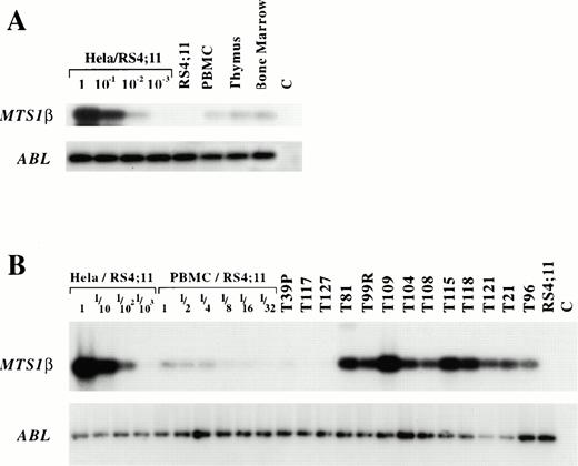 Fig. 3. MTS1β expression in immature T cells. (A) RT-PCR detection of MTS1β and ABL transcripts. RT-PCR analysis of MTS1β (encoding p19ARF, 26 PCR cycles) and ABL transcript expression (30 PCR cycles) in leukemic samples and controls. PCR products were electrophoresed on agarose gels, transferred to filters, and hybridized with specific radiolabeled probes. c: control (no cDNA). (B) RT-PCR detection ofMTS1β transcripts in thymus, bone marrow, and PBMC. PCR products were electrophoresed on agarose gels, transferred to filters, and hybridized with specific radiolabeled probes. Hela and RS4;11 expression were used as positive and negative controls forMTS1/2 expression, respectively. MTS1β and Abl transcripts were studied using 27 and 30 PCR cycles, respectively.