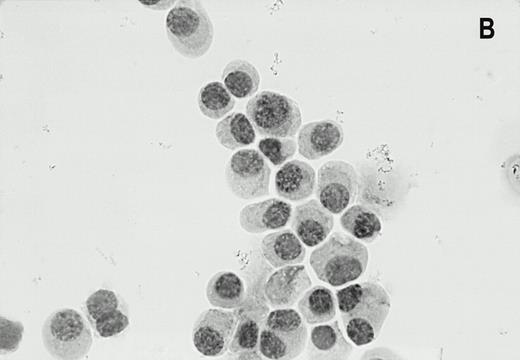 Fig. 1. Alkaline phosphatase immunocytohistochemical staining using the MoAb LRP-56 of cytocentrifuged bone marrow cells containing >95% plasma cells of a patient with multiple myeloma. Cytospins were counterstained in diluted hemotoxiline. LRP immunoreactivity in a granular fashion in the cytoplasm is present in almost all plasma cells (A). Isotype control is negative (B).
