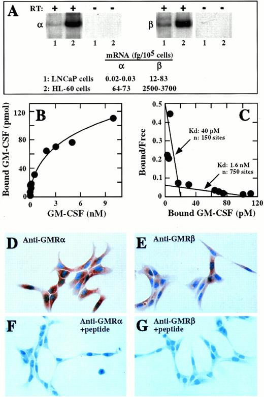 Fig. 1. Expression of GM-CSF receptors in LNCaP cells. (A) RT-PCR analysis. Total RNA was isolated from LNCaP (lane 1) or HL-60 (lane 2) cells and subjected to RT-PCR using radiolabeled primers specific for the α (left panel) or the β (right panel) subunits of the GM-CSF receptor. PCR products were size-fractionated on 5% acrylamide gels and autoradiographed. Shown are the PCR products corresponding to the α (370 bp) and the β (570 bp) subunits of the GM-CSF receptor obtained in the presence (+) or in the absence (-) of reverse transcriptase (RT). (B) Binding analysis. Cells were incubated with radiolabeled GM-CSF at concentrations that ranged from 5 pmol/L to 10 nmol/L. GM-CSF binding was dose dependent and saturable approximately at 10 nmol/L. (C) Scatchard analysis of data from (B) showing the presence of two classes of binding sites in the LNCaP cells. (D through G) Immunostaining with antihuman GM-CSF receptor antibodies. Cells were cultured, fixed, and incubated with anti-α (D and F) or anti-β subunit (E and G) antibodies in the absence (D and E) or the presence (F and G) of the peptides used to elicit them (original magnification × 160).