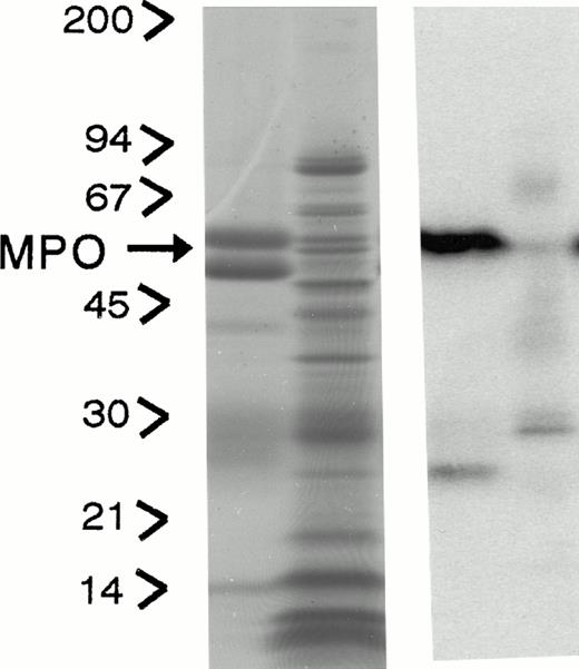 Fig. 1. Subcellular distribution of LAMP 1 and 2 and Man 6-P GP in neutrophils. Neutrophils from PB were isolated, disrupted by nitrogen cavitation, and fractionated on a two-layer Percoll Density gradient. (A) LAMP 1 and 2 in subcellular fractions. Other fractions of 1.4 mL were collected and assayed for markers of azurophil granules (MPO, ▪), specific granules (lactoferrin, ▴), gelatinase granules (gelatinase, ▾), secretory vesicles (albumin, X), and plasma membranes (HLA, class I, *). Samples from each fraction were centrifuged to remove Percoll and subjected to SDS-PAGE. The separated proteins were blotted to nitrocellulose membranes and probed with antibody against LAMP 1 (•) and LAMP 2 (⧫). The immunoblots were developed by chemiluminescence and quantitated by scanning (bold lines). (B) Man 6-P GP in subcellular fractions. Fractions of 1.4 mL were collected and assayed for markers of azurophil granules (MPO, ▪), specific granules (lactoferrin, •), gelatinase granules (gelatinase, ⧫), secretory vesicles (albumin, X ), and plasma membranes (HLA, class I, *). Samples from each fraction were centrifuged to remove Percoll and subjected to SDS-PAGE. The separated proteins were blotted to nitrocellulose membranes and probed with the sCI-MPR (★) and quantified by phosphorimager (bold line). (C) Man 6-P GP in relation to myeloperoxidase. Isolated neutrophils were disrupted by nitrogen cavitation and the postnuclear supernatant was immunoprecipitated with anti-MPO coupled to sepharose particles, divided into two, and subjected to SDS-PAGE and Coomassie blue staining for protein (left panel) or to SDS-PAGE followed by transfer to nitrocellulose and probed with sCI-MPR (right lane). From left to right: Lane 1, protein profile in immunoprecipitate; lane 2, protein profile in supernatant after immunoprecipitation; lane 3, Man 6-P GP in immunoprecipitate; lane 4, Man 6-P GP in supernatant after immunoprecipitation. (D) Profile of Man 6-P GP in fraction #3 and #10.