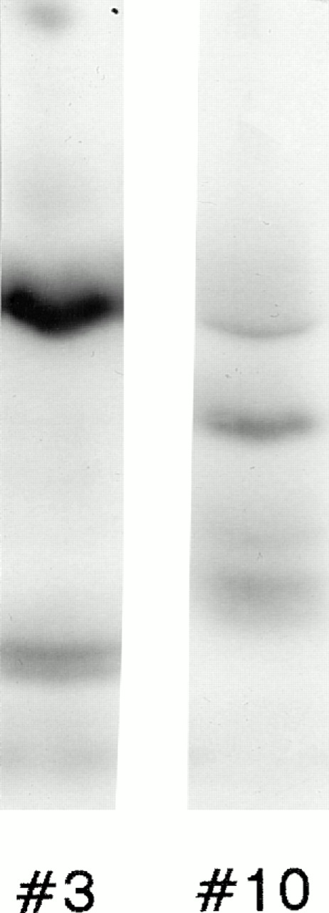 Fig. 1. Subcellular distribution of LAMP 1 and 2 and Man 6-P GP in neutrophils. Neutrophils from PB were isolated, disrupted by nitrogen cavitation, and fractionated on a two-layer Percoll Density gradient. (A) LAMP 1 and 2 in subcellular fractions. Other fractions of 1.4 mL were collected and assayed for markers of azurophil granules (MPO, ▪), specific granules (lactoferrin, ▴), gelatinase granules (gelatinase, ▾), secretory vesicles (albumin, X), and plasma membranes (HLA, class I, *). Samples from each fraction were centrifuged to remove Percoll and subjected to SDS-PAGE. The separated proteins were blotted to nitrocellulose membranes and probed with antibody against LAMP 1 (•) and LAMP 2 (⧫). The immunoblots were developed by chemiluminescence and quantitated by scanning (bold lines). (B) Man 6-P GP in subcellular fractions. Fractions of 1.4 mL were collected and assayed for markers of azurophil granules (MPO, ▪), specific granules (lactoferrin, •), gelatinase granules (gelatinase, ⧫), secretory vesicles (albumin, X ), and plasma membranes (HLA, class I, *). Samples from each fraction were centrifuged to remove Percoll and subjected to SDS-PAGE. The separated proteins were blotted to nitrocellulose membranes and probed with the sCI-MPR (★) and quantified by phosphorimager (bold line). (C) Man 6-P GP in relation to myeloperoxidase. Isolated neutrophils were disrupted by nitrogen cavitation and the postnuclear supernatant was immunoprecipitated with anti-MPO coupled to sepharose particles, divided into two, and subjected to SDS-PAGE and Coomassie blue staining for protein (left panel) or to SDS-PAGE followed by transfer to nitrocellulose and probed with sCI-MPR (right lane). From left to right: Lane 1, protein profile in immunoprecipitate; lane 2, protein profile in supernatant after immunoprecipitation; lane 3, Man 6-P GP in immunoprecipitate; lane 4, Man 6-P GP in supernatant after immunoprecipitation. (D) Profile of Man 6-P GP in fraction #3 and #10.