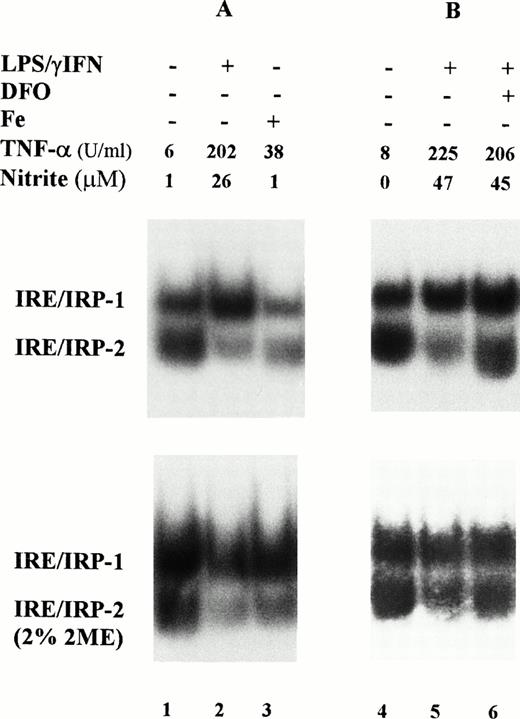 Fig. 1. Modulation of IRP-1 and IRP-2 activity in cytokine-treated macrophage J774 cells. J774 cells were left untreated or treated for 24 hours with cytokines (100 U/mL IFN-γ plus 1 μg/mL LPS); where indicated, the iron chelator DFO (0.05 mmol/L) was also added. Iron loading was obtained by incubating cells with 50 μg/mL ferric ammonium citrate for 24 hours (lane 3). A total of 2 μg protein of cytoplasmic extracts was analyzed for IRE-binding activity by RNA gel retardation assay with excess 32P-labeled RNA transcribed from the pSPT-fer probe containing the IRE of the ferritin H mRNA in the absence (upper panels) or presence (lower panels) of 2% 2-mercaptoethanol. TNF-α and nitrite production was assayed in the culture medium as described in Materials and Methods. TNF-α units were calculated from a standard curve with rTNF-α used as internal standard for each test.
