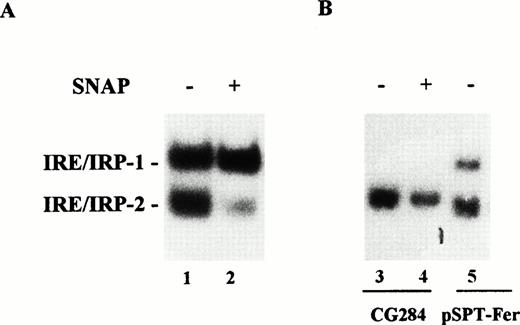 Fig. 4. Effect of NO on IRP-1 and IRP-2 activity of macrophage J774 cells. (A) J774 cells were left untreated or treated with the NO donor SNAP (0.5 mmol/L) for 24 hours as indicated. IRP activity in cytoplasmic extracts was determined by bandshift assay using the pSPT-fer probe as described in the legend to Fig 1. The results shown are representative of seven separate experiments. (B) The mutant CG284 probe, which is specific for IRP-2, was incubated with lysates (10 μg protein) of J774 cells untreated and treated with 0.5 mmol/L SNAP for 24 hours as indicated. The pSPT-fer probe was incubated with lysates (2 μg protein) of untreated cells. Formation of RNA/protein complexes was estimated by bandshift assay as described in the legend to Fig 1. The autoradiogram shown is representative of four separate experiments.