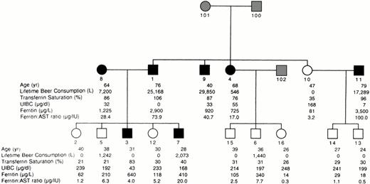 Fig. 1. Pedigree Z-34. Filled symbols designate iron overload defined from liver biopsy (individual no. 1), high transferrin saturation and ferritin (individuals no. 8, 9, and 11), a probability >90% of heterozygosity in the analyses of transferrin saturation and unsaturated iron binding capacity (individual no. 4), or a probability >70% in the analyses of ferritin and the ferritin to AST ratio (individuals no. 3, 4, and 7). Open symbols designate studied individuals for whom iron overload criteria were not met. Shaded symbols designate unstudied individuals. Individual no. 5 was assigned unaffected status in the analysis because of low transferrin saturation and ferritin to AST ratio despite consuming >1,000 L beer. Individual no. 6 had a probability >90% of being a normal homozygote in the analyses of transferrin saturation and unsaturated iron binding capacity.