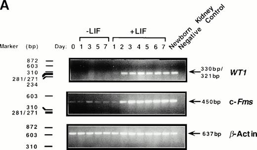 Fig. 1. Induction of WT1 expression during LIF-induced macrophage differentiation of M1 cells. M1 cells were cultured in the presence or absence of LIF (1 ng/mL) for the indicated timepoints and assessed for: (A) expression of WT1,c-fms, and β-actin as determined by RT-PCR analysis of total RNA extracted from the cells (or from newborn murine kidney as a positive control), with the size and position of the ◊X174/HaeIII molecular weight markers indicated to the left of the gels; and (B) morphological differentiation as determined by Leishman's staining of cytospin preparations of the cells and scoring the proportion of blast cells to cells at intermediate monocytic and mature macrophage stages. (▪), M1 +LIF; (□), M1−LIF.