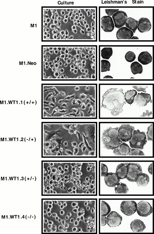 Fig. 2. Induction of spontaneous monocytic differentiation in M1 cells transfected with WT1 +KTS isoforms. M1 cells stably transfected with retroviral vectors containing cDNAs encoding individual WT1 isoforms were compared with parental cells or control M1.Neo cells generated by transfection with a retroviral vector encoding neomycin-resistance. Differences in morphology were examined in culture (original magnification ×200) and by Leishman's staining of cytospin preparations (original magnification ×800).