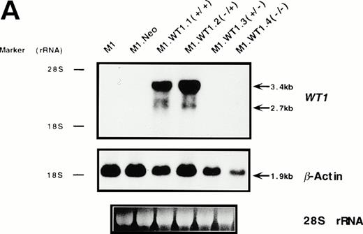 Fig. 3. Stable ectopic expression of WT1 +KTS isoforms, but not −KTS isoforms, in M1 cells. (A) Northern blotting of total RNA followed by hybridization with probes to WT1 and β-actin, with the 28S rRNA band shown below to illustrate equal loading of the samples on the gel, and the position of the 28S and 18S rRNA bands indicated to the left of the autoradiographs. (B) Western blotting of protein lysates followed by hybridization with an antibody specific for WT1, with an identical gel stained for total protein shown below to illustrate equal loading of the samples, and the size and position of the protein molecular weight markers indicated to the left of the autoradiograph.