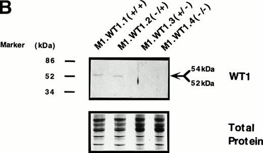 Fig. 3. Stable ectopic expression of WT1 +KTS isoforms, but not −KTS isoforms, in M1 cells. (A) Northern blotting of total RNA followed by hybridization with probes to WT1 and β-actin, with the 28S rRNA band shown below to illustrate equal loading of the samples on the gel, and the position of the 28S and 18S rRNA bands indicated to the left of the autoradiographs. (B) Western blotting of protein lysates followed by hybridization with an antibody specific for WT1, with an identical gel stained for total protein shown below to illustrate equal loading of the samples, and the size and position of the protein molecular weight markers indicated to the left of the autoradiograph.