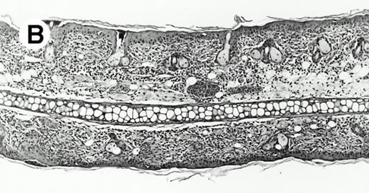 Fig. 3. IL-3 is required for hapten specific priming. (A) IL-3–deficient (□) and wild-type littermate controls (▪) (BALB/c) were tested for contact hypersensitivity to oxazolone. One hundred nanograms of murine IL-3 (in 1% mouse serum) (□) or vehicle only was administered intraperitoneally and subcutaneously (abdomen) 4 hours before, at the time of sensitization, and 6 hours afterwards. +/+ versus −/−, P = .03. −/− plus murine IL-3 versus −/−, P = .008. Murine IL-3 administered to unsensitized mice had no effect on secondary challenge. (B through D) Histopathology (tissues were formalin-fixed, paraffin-embedded, and stained with hematoxylin and eosin) of secondary oxazolone challenge sites in ears from mice (BALB/c background) killed 24 hours after challenge. (B) Ear reaction of a sensitized wild-type mouse. (C) Ear reaction of a sensitized IL-3–deficient mouse. (D) Ear reaction of a sensitized IL-3–deficient mouse administered IL-3 protein at the time of priming.