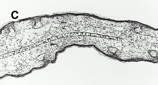 Fig. 3. IL-3 is required for hapten specific priming. (A) IL-3–deficient (□) and wild-type littermate controls (▪) (BALB/c) were tested for contact hypersensitivity to oxazolone. One hundred nanograms of murine IL-3 (in 1% mouse serum) (□) or vehicle only was administered intraperitoneally and subcutaneously (abdomen) 4 hours before, at the time of sensitization, and 6 hours afterwards. +/+ versus −/−, P = .03. −/− plus murine IL-3 versus −/−, P = .008. Murine IL-3 administered to unsensitized mice had no effect on secondary challenge. (B through D) Histopathology (tissues were formalin-fixed, paraffin-embedded, and stained with hematoxylin and eosin) of secondary oxazolone challenge sites in ears from mice (BALB/c background) killed 24 hours after challenge. (B) Ear reaction of a sensitized wild-type mouse. (C) Ear reaction of a sensitized IL-3–deficient mouse. (D) Ear reaction of a sensitized IL-3–deficient mouse administered IL-3 protein at the time of priming.