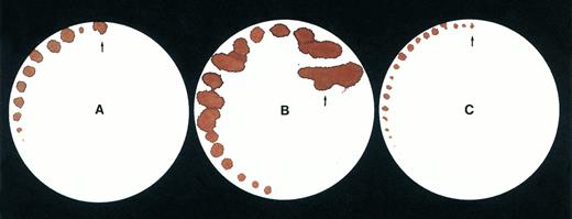 Fig. 3. Tail bleeding time by a filter paper method. Data are shown for (A) a normal mouse, (B) a C57B1/6 hemophilic mouse, (C) a treated C57B1/6 hemophilic mouse 1 week after injection of Ad-F.IX vector.