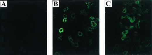 Fig. 5. Immunofluorescence staining for human F.IX on liver sections from treated and untreated hemophilic mice. (A) Untreated C57B1/6 hemophilic mouse. (B) Treated C57B1/6 hemophilic mouse 2 weeks after Ad-F.IX injection. (C) Treated CD-1 hemophilic mouse 2 weeks after Ad-F.IX injection. Original magnification ×200.