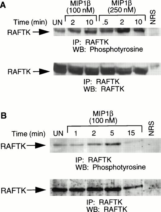 Fig. 2. Tyrosine phosphorylation of RAFTK in CCR5-L1.2 cells and activated T cells in response to chemokines. (A) CCR5-L1.2 cells or (B) T cells were unstimulated (UN) or stimulated with 100 nmol/L or 250 nmol/L MIP1β for varying time intervals. Cells were lysed and immunoprecipitated with anti-RAFTK, and analyzed by immunoblotting with antiphosphotyrosine (anti-pTyr). The same immunoblot was stripped and immunoblotted with anti-RAFTK (lower panel).