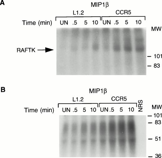 Fig. 3. RAFTK activation upon chemokine stimulation. Total cell lysates from L1.2 or CCR5-L1.2 cells unstimulated (UN) or stimulated with MIP1β (25 nmol/L) were immunoprecipitated with RAFTK antibody. The immune complexes were subjected to (A) autophosphorylating activity or (B) in vitro kinase assays using poly (Glu/Tyr, 4:1) substrate. The32P-incorporated proteins were resolved on 7.5% SDS-PAGE followed by autoradiography. Both autokinase and total kinase activity were increased upon stimulation of the CCR5-L1.2 cells with MIP1β.