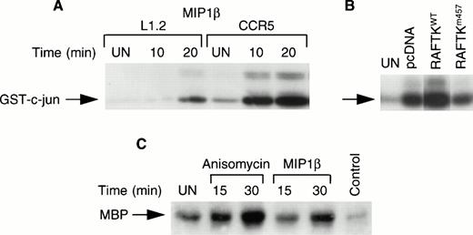 Fig. 4. Activation of JNK and p38 kinase upon chemokine stimulation. (A) L1.2 and CCR5-L1.2 cells were stimulated with MIP1β and were immunoprecipitated with JNK antibody and subjected to in vitro kinase assay using GST–c-jun (1-79 amino acids) as substrates. The experiment was repeated three times with similar results. (B) CCR5-L1.2 cells were stably transfected with vector control pcDNA, RAFTKwt or RAFTKm457. The transfectants were stimulated with MIP1β (25 nmol/L) for 15 minutes and the cells were lysed, immunoprecipitated with JNK antibody, and subjected to kinase assay. (C) CCR5-L1.2 cells were stimulated with MIP1β or anisomycin and cell lysates were immunoprecipitated with p38 kinase antibody. The immune complexes were subjected to kinase assay using MBP as a substrate.