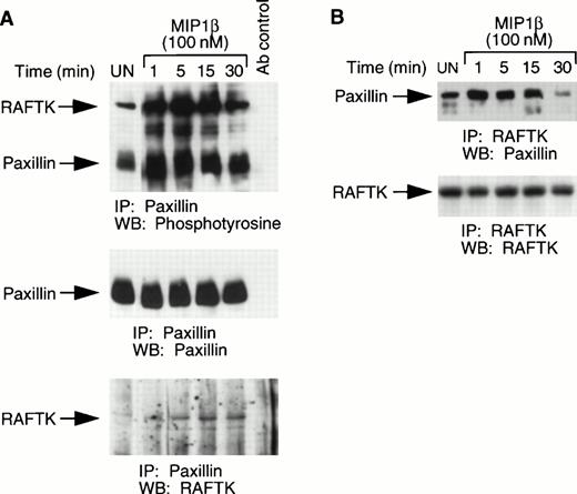 Fig. 5. Phosphorylation of paxillin and its association with RAFTK. (A) CCR5-L1.2 cells were stimulated with 100 nmol/L MIP1β for varying time intervals, and stimulated or unstimulated cell lysates were immunoprecipitated with anti-paxillin antibody. The immune precipitates were then run on SDS-PAGE and subjected to Western blotting with phosphotyrosine antibody, followed by antipaxillin and anti-RAFTK antibodies. (B) Stimulated or unstimulated cell lysates were immunoprecipitated with RAFTK antibody and blotted with paxillin antibody, followed by RAFTK antibody.