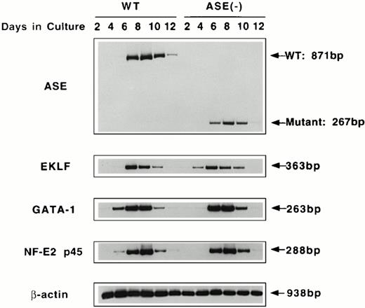 Fig. 3. RT-PCR analysis of the expression of erythroid transcription factors in EBs. Expression of mRNAs coding for ALAS-E and erythroid transcription factors GATA-1, p45, and EKLF were examined by RT-PCR. RNA samples were obtained from day 2 through day 12 EBs in culture. WT, wild-type EBs; ALAS-E(-), ALAS-E(-) EBs.