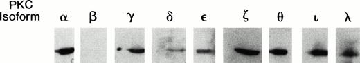 Fig. 1. Immunoblot of PKC isoforms present in TF-1 cells. Exponentially growing TF-1 cells were lysed and proteins were separated by electrophoresis through 10% sodium dodecyl sulfate (SDS) polyacrylamide gels. Separated proteins were analyzed by immunoblotting with a series of commercially available isoform specific antibodies (Transduction Laboratories). The isoforms were visualized by chemiluminescence and exposure to x-ray film.