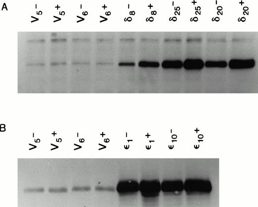 Fig. 2. Expression of PKC isoforms in selected TF-1 transfectants. TF-1 cells were transfected with appropriate plasmids containing either PKC or δ cDNA inserts. Transfectants were selected in the antibiotic G418. Isoform overexpression was determined either with (+) or without (-) induction with 70 μmol/L zinc acetate for 18 hours. Enzyme overexpression was detected by immunoblotting after proteins were separated by electrophoresis in a 10% SDS polyacrylamide gel. Results from immunoblots of isoform transfected cells probed with affinity purified rabbit polyclonal antibodies against murine PKC and cross-reacting with the human protein (GIBCO/BRL) are shown in (A), and results from δ transfected cells probed with antipeptide monoclonal antibodies recognizing both murine and human PKCδ (Transduction Laboratories) are shown in (B). Levels of overexpression were determined by digitizing ECL film images on the blots and analyzing the images with the 1D Gel Scan program (Scanalytics). Levels of PKC overexpression between and δ transfectants cannot be compared in this figure because it is a composite of immunoblots from two different experiments.