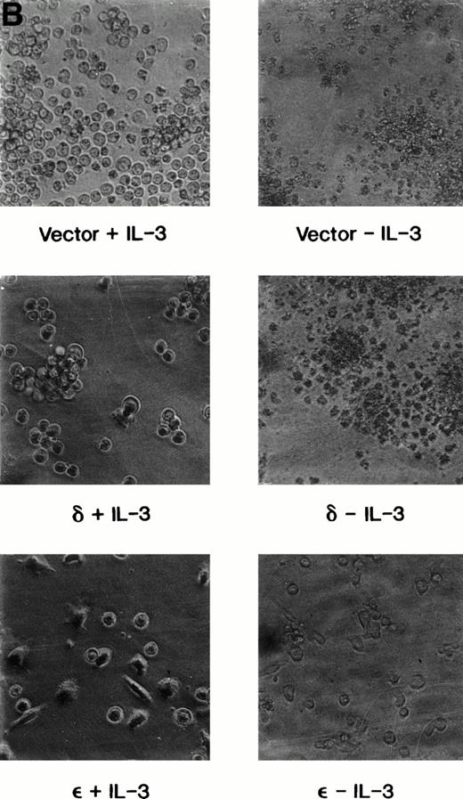 Fig. 4. Survival of vector and PKC TF-1 cell transfectants after IL-3 deprivation. Cells were deprived of IL-3 for increasing periods of time and cell viability was determined by vital dye exclusion and enumeration of viable cells by light microscopy. (A) Transfectants represented are vector (▴-▴, ▵▵), PKC1 (□-□), PKC10 (▪-▪), PKCδ8 (○-○), and PKCδ25 (•-•). The percentage of viable cells is expressed in relation to the viable cell count at the beginning of the experiment. The experiment was repeated three times with similar results each time. (B) Photomicrographs of representative transfectants after 72 hours in the presence (+) or absence (-) of IL-3.