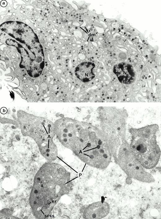 Fig. 9. Ultrastructure of platelet shedding MKs and platelets obtained in the presence of PEG-rHuMGDF from CD34+CD41+ cells. (a) A mature MK presenting signs of platelet formation. This MK displays dilatation of the demarcation membranes (dm) located at the periphery. They individualize a zone of cytoplasm (arrows) which will form a future proplatelet (N, nucleus). (b) Platelet-sized-fragments (P) exhibit the usual cytoplasmic organelles: α granules (A), smooth connected canalicular system (sccs), and endoplasmic reticulum (er).