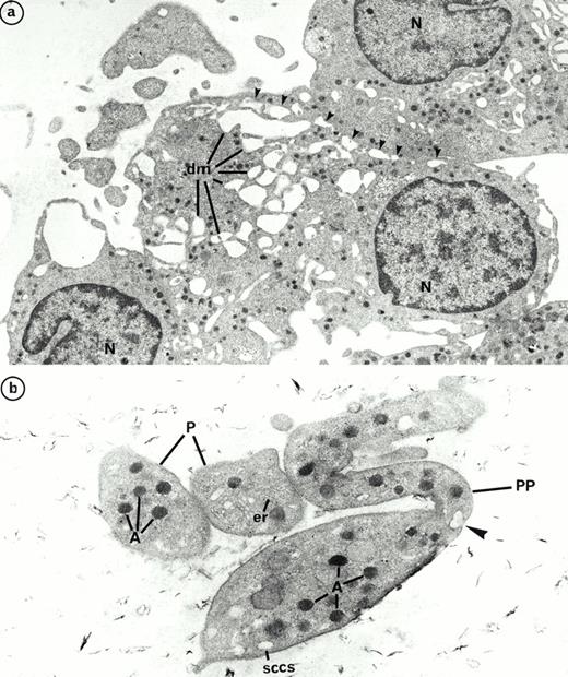 Fig. 10. Ultrastructure of platelet shedding MKs and platelets obtained in the presence of the combination of SCF, IL-3, and IL-6 from CD34+ CD41+ cells. (a) A similar mature MK as in Fig 9a with dilatation of demarcation membranes (dm) at the periphery (arrows) (N, nucleus). (b) Platelet-sized-fragments (P) are present with the combination of three cytokines. They are similar to those obtained with PEG-rHuMGDF (Fig 9b). On a proplatelet (PP), a constriction zone area is disposed along the cytoplasmic extension individualizing a distinct platelet field with a vacuole at the level of the future rupture (arrow) (A, α granules; sccs, smooth connected canalicular system; er, endoplasmic reticulum).