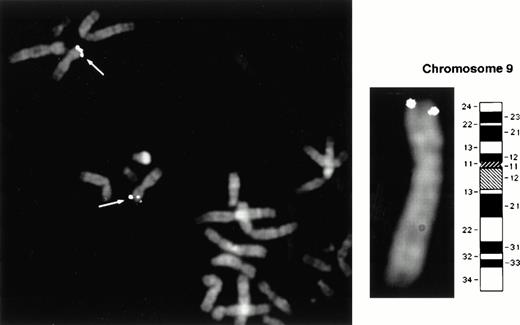 Fig. 3. Chromosomal localization of the human Jak2 gene. Positional mapping was performed by FISH to normal human lymphocyte metaphase chromosomes. Both a 1.5-kb Jak2 cDNA probe and a corresponding genomic probe obtained by screening a PAC library showed positive signals in >95% of the cells on both chromatids of each homolog of chromosome 9p23-24, as indicated by the arrows.