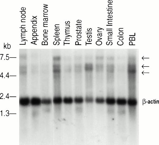 Fig. 4. Northern blot analysis of human Jak2 expression. Commercial membranes containing 2 μg Poly A+ mRNA per lane of various human tissues (Clontech) were probed with a 400-bp cDNA corresponding to the 3′ end of human Jak2. Hybridization and washing of the membranes were performed according to the manufacturer's specifications (Clontech). β-Actin was used for comparison of RNA loading.